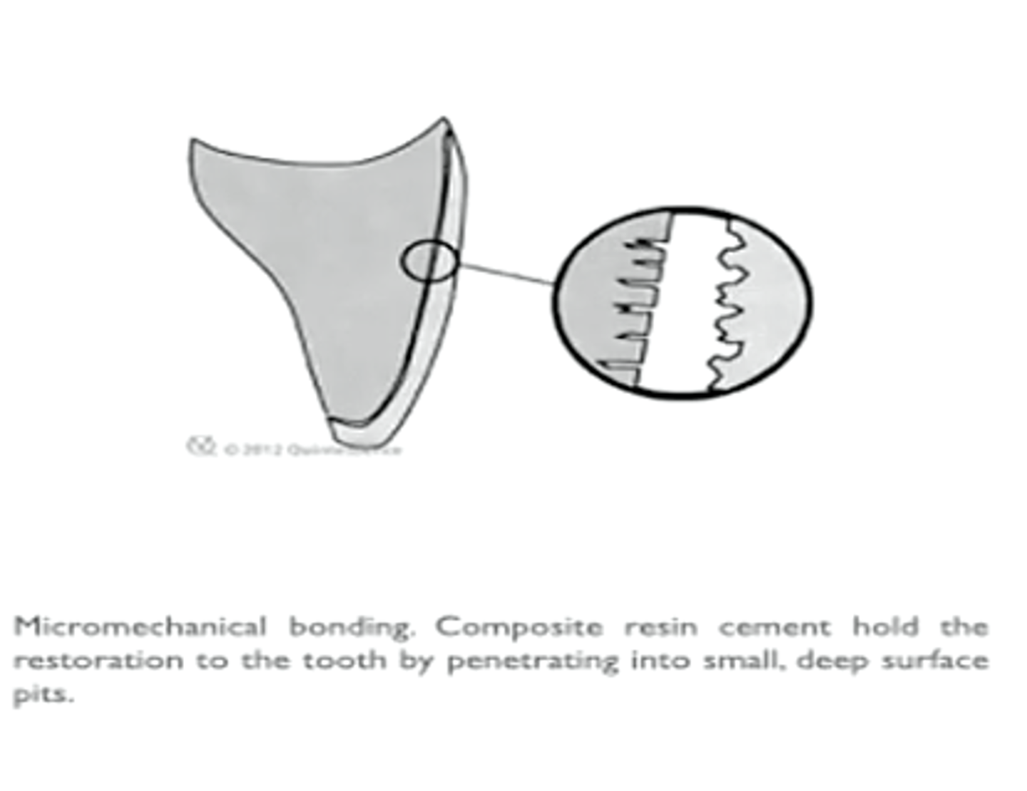 <p>Micromechanical bonding of the tooth to the prep (mechanical retention and frictional resistance)</p>