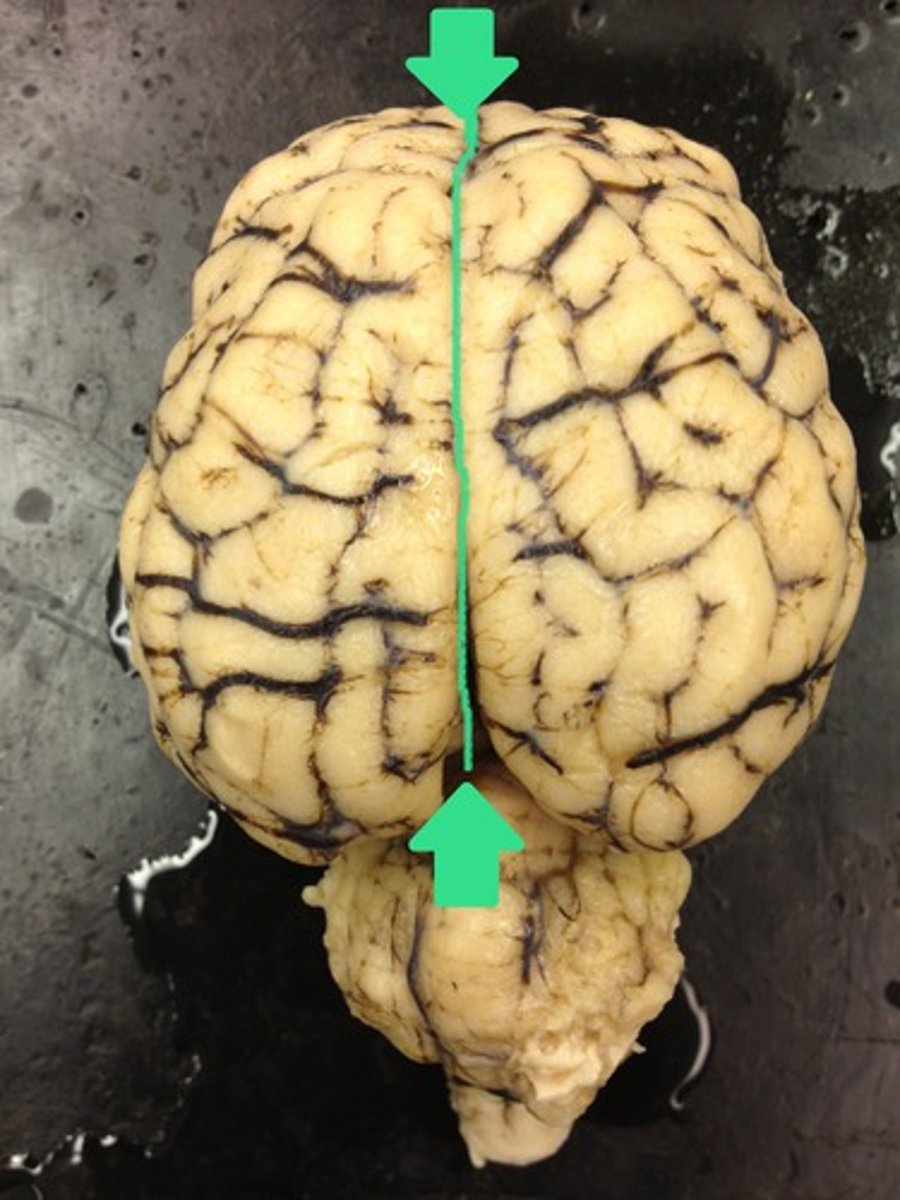 <p>- deep furrow b/t right and left hemispheres</p>