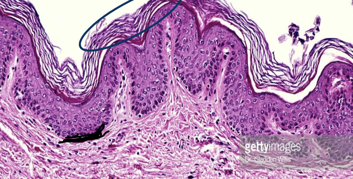 <p>What type of tissue is present in this image?</p>