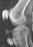 <p>ontsteking pre-patellaire bursa</p>