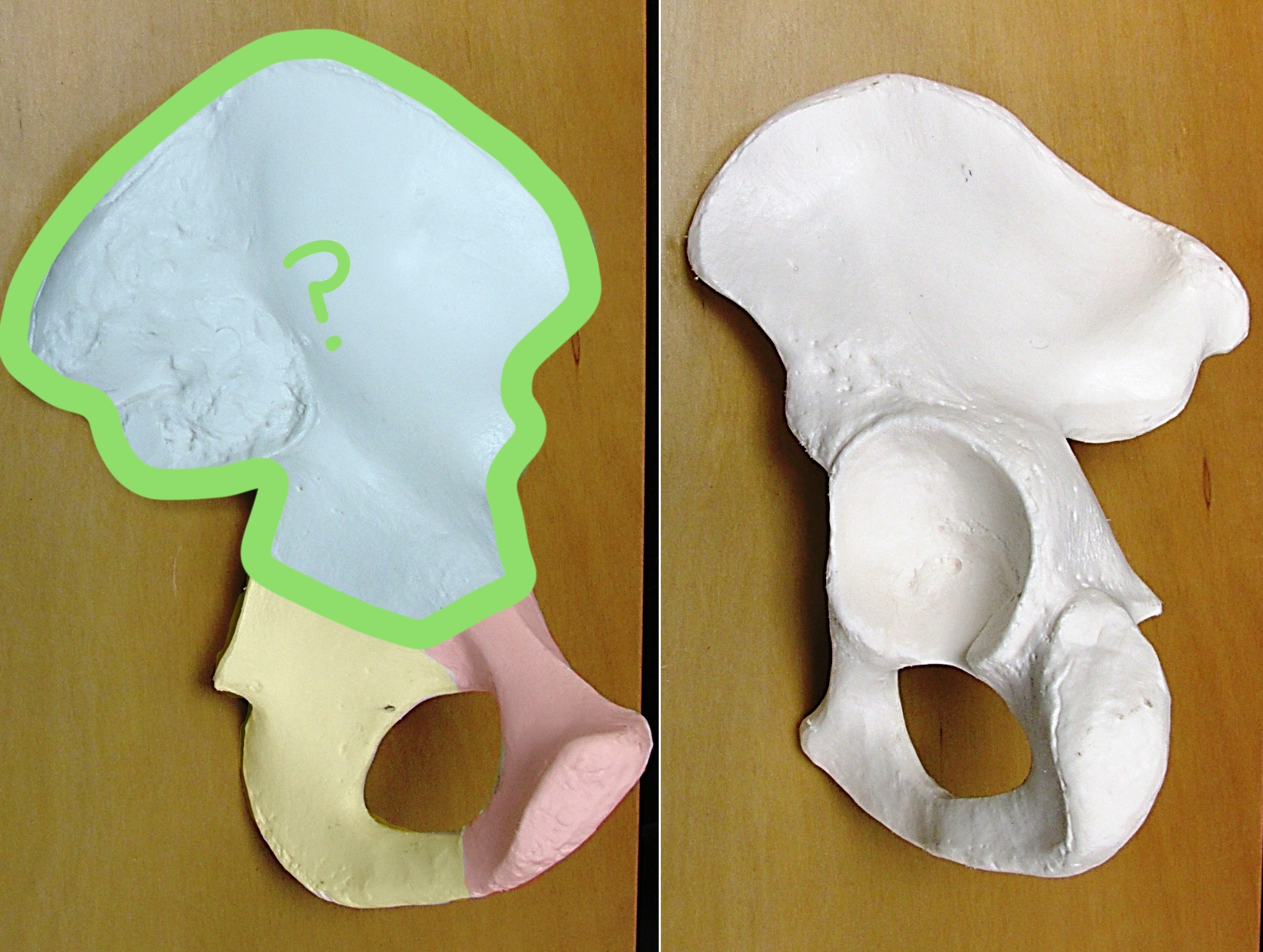 <p>Determine the part of the Coxa highlighted</p>