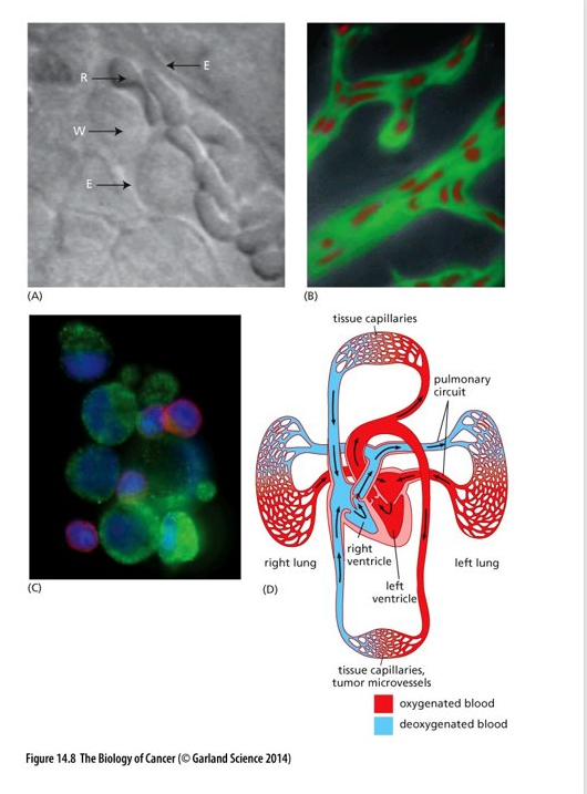 <ul><li><p class="Paragraph WhiteSpaceCollapse SCXP128986333 BCX0" style="text-align: left"><span>May persist for only a short time in circulation – unlike red blood cells and white blood cells they are not able to pass through many microvessels (capillaries to small)​</span></p></li><li><p class="Paragraph WhiteSpaceCollapse SCXP128986333 BCX0" style="text-align: left"><span>Most get trapped in lung capillary beds​</span></p></li><li><p class="Paragraph WhiteSpaceCollapse SCXP128986333 BCX0" style="text-align: left"><span>Possibility that some find a way to circumvent capillaries​</span></p></li><li><p class="Paragraph WhiteSpaceCollapse SCXP128986333 BCX0" style="text-align: left"><span>(A) E = capillary wall; W = leukocyte; R = erythrocyte​</span></p></li><li><p class="Paragraph WhiteSpaceCollapse SCXP128986333 BCX0" style="text-align: left"><span>(B) notice how the erythrocytes are deformed to be able to move through the vessel​</span></p></li><li><p class="Paragraph WhiteSpaceCollapse SCXP128986333 BCX0" style="text-align: left"><span>(C) CTCs often found in aggregates​</span></p></li></ul><p></p>