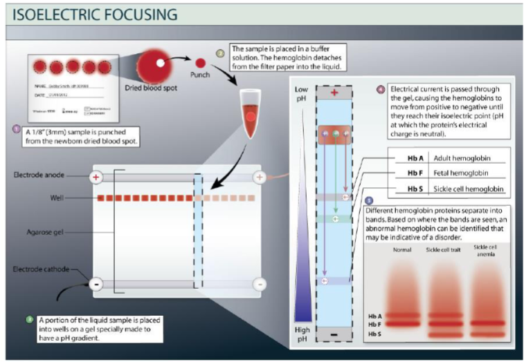 <p>Blood spot test</p>