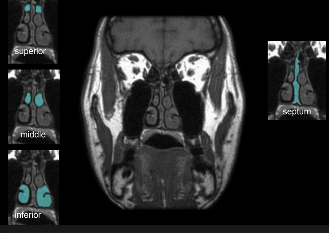<p>inferior, middle, superior</p>