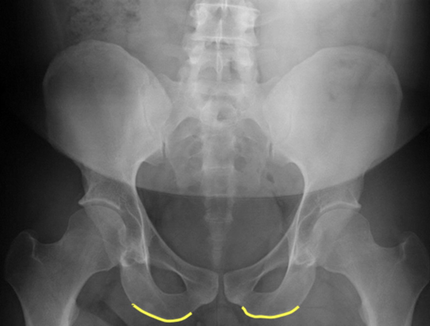 <p>What are outlined in yellow?</p>