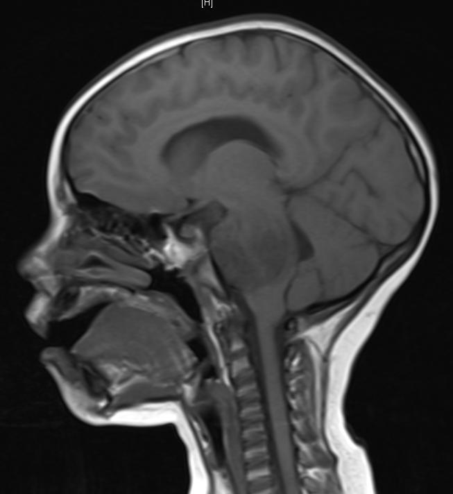 <p><span>In which of the following planes would you be viewing a persons body from the SIDE, as in the following CT scan of a human head?</span></p>