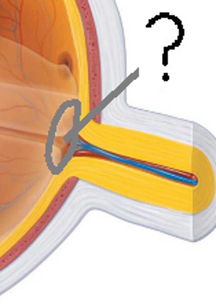 <p>-point where optic nerve leaves eye creating "blind spot"</p><p>-no cell receptors there</p>