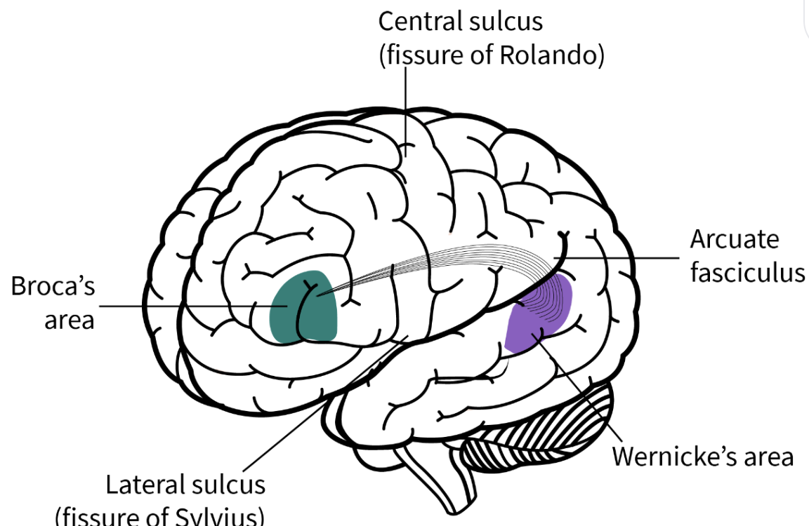 <p>T<span>he study of brain function and impairment due to brain pathology</span></p><ul><li><p><span><strong>Aphasia</strong>: the loss of language comprehension or expression due to brain damage</span></p></li><li><p><span><strong>Broca’s/Expressive aphasia</strong>: a form of aphasia typically due to damage to the inferior frontal gyrus that leads to slow and laboured <u>speech production</u></span></p><ul><li><p><span>Slow and deliberate speech and writing</span></p></li><li><p><span>Problems with identifying words and forming sentences</span></p></li></ul></li><li><p><span><strong>Wernicke’s/Receptive aphasia</strong>: form of aphasia typically due to damage to the superior temporal gyrus that leads to fluid/fluent but <u>nonsensical speech production</u>, people with this also have issues <u>understanding language</u></span></p><ul><li><p><span>Fluid speech that lacks meaning</span></p></li><li><p><span>Difficulty understanding language being spoken to them</span></p></li></ul></li><li><p><span>Speech therapy can help people overcome these incurable conditions, but it depends on how damaged their brain is&nbsp;</span></p></li><li><p><span>Language processing is doubly dissociated - one function can be maintained while the other is impaired</span></p></li></ul><p></p>
