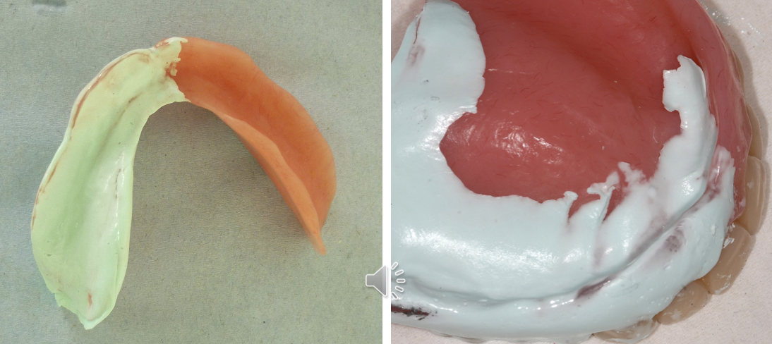 <ul><li><p>where the denture shows through the PSI paste are where the pressure spots are</p></li></ul><p></p>