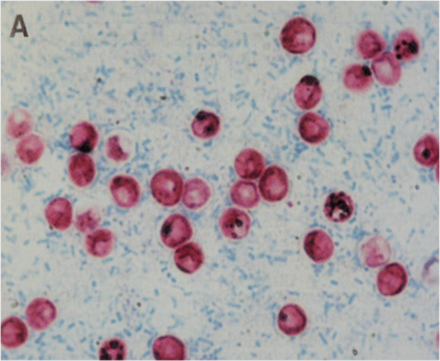 <p>increase CD4 >500 and reduce viral load</p>