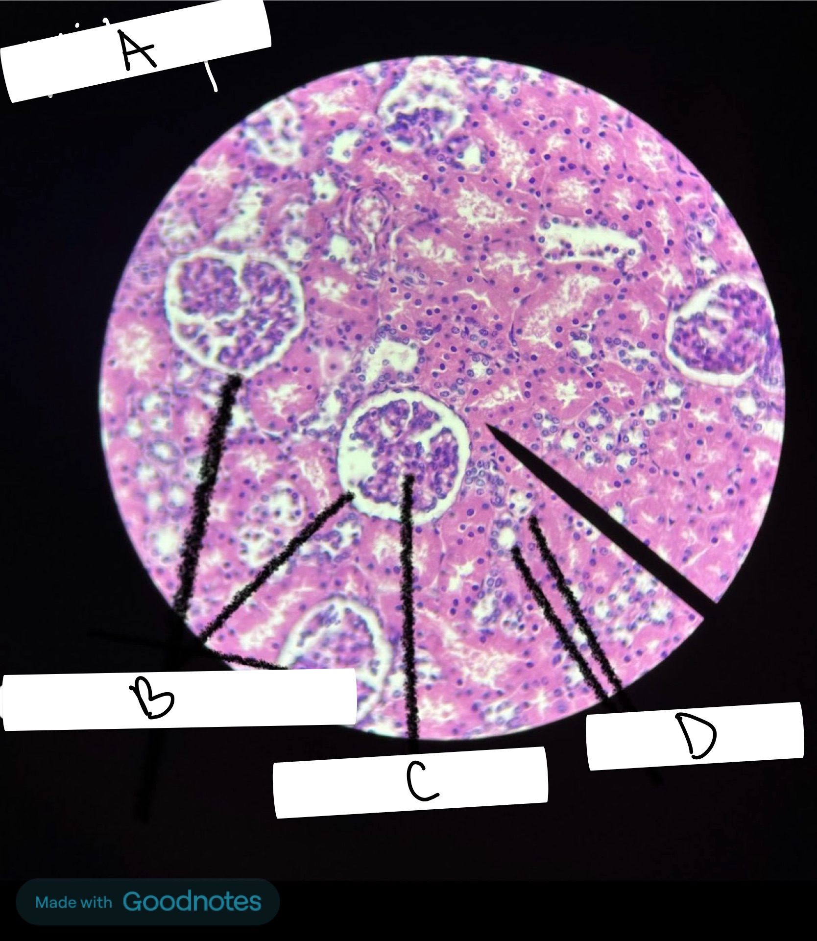 <p>What is the name of this organ labeled A</p>