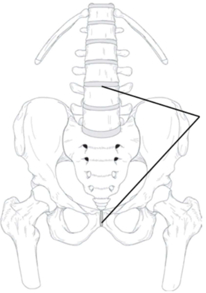 <p>What is the structural classification of this joint?</p>