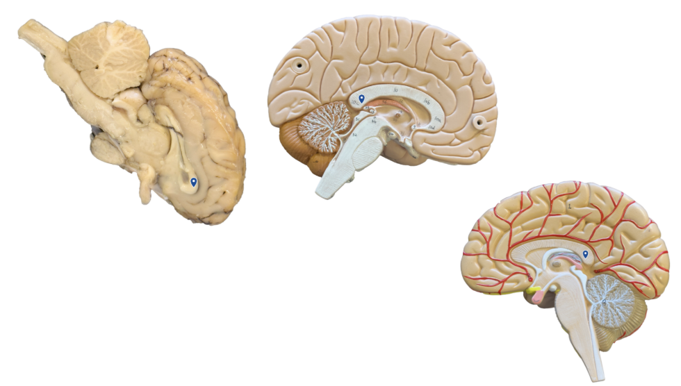 <p>What structure is the arrow pointing to?</p>