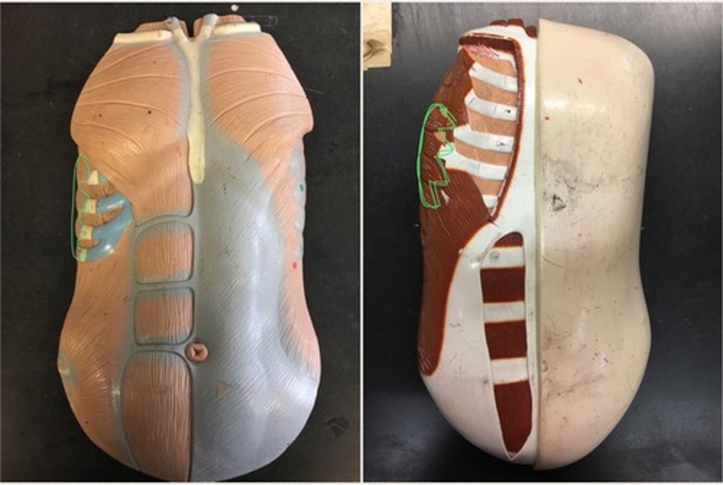 <p>muscle on your side; looks like bear claw, (grayish on model); also connects to ribs</p>