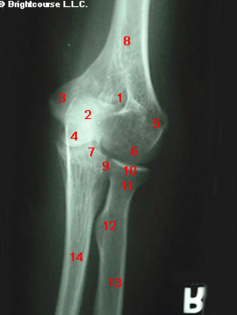 <p>What structure is indicated by number 11?</p>