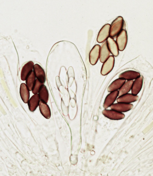 <p><span style="background-color: transparent;"><strong><span>The Ascus (pl. asci) defines the Ascomycota</span></strong></span></p>