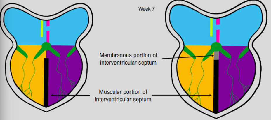 <ul><li><p>muscular portion of interventricular septum</p></li><li><p>as is reaches septum intermedium, membrane forms and fuses to muscular portion</p></li></ul><p></p>