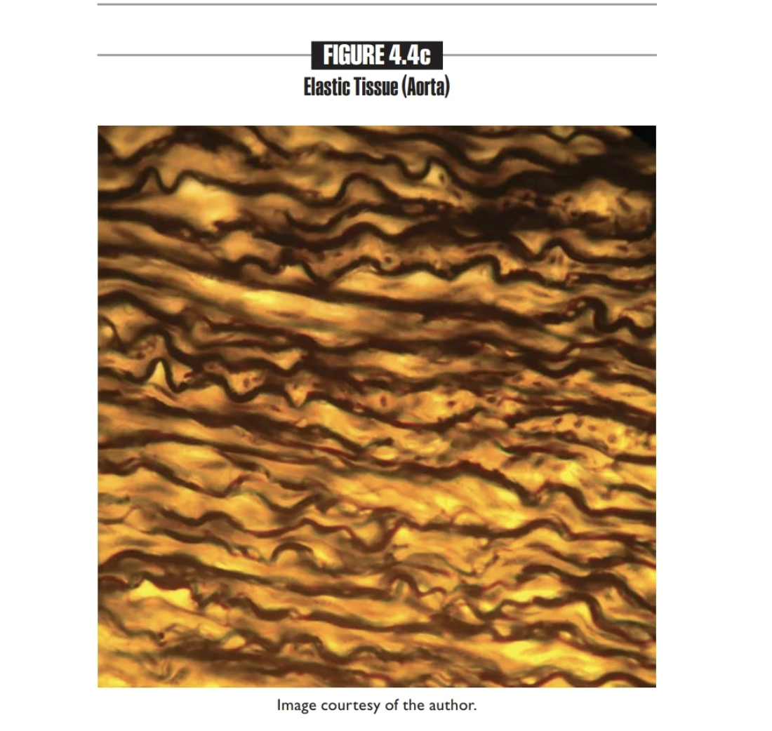 <p>Elastic tissue</p><p></p>