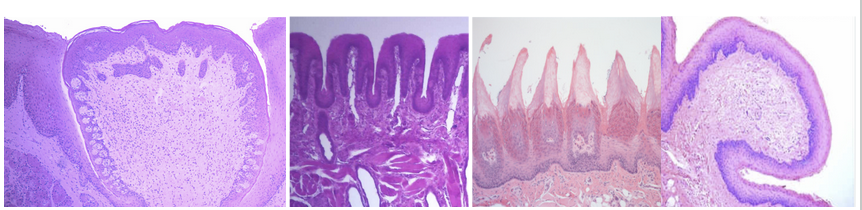 <p><span><strong>Label the types of lingual papillae and identify which contains the majority of taste buds and which are keratinized. Which are most numerous in children?&nbsp;</strong></span></p>