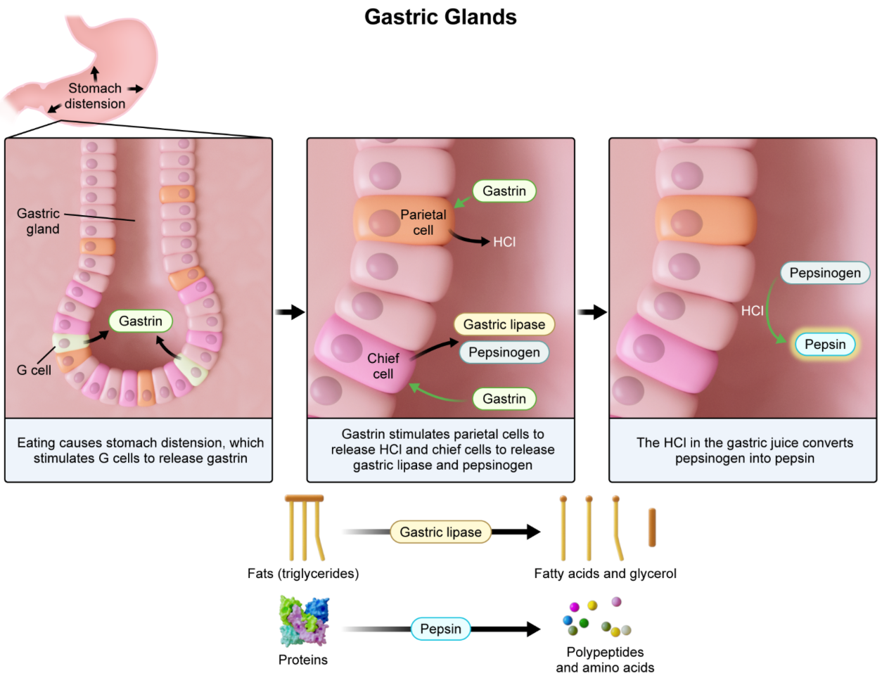 <p><strong>B. gastrin </strong>| When a food bolus reaches the stomach, the resulting distension stimulates G cells to release gastrin. <strong>gastrin </strong>is a hormone with two main functions:</p><ol><li><p>stimulates <u>parietal cells</u> in the stomach to release gastric juice (gastric juice is why the pH of the stomach is acidic)</p></li><li><p>stimulates chief cells in the stomach to secrete gastric lipase and pepsinogen, which are digestive enzymes</p><ul><li><p>gastric lipase breaks down fats</p></li><li><p>pepsinogen is a zymogen (i.e., inactive) form of pepsin, a protease (i.e., it breaks down proteins). once release into the topic, pepsinogen is converted into pepsin by the hydrochloric acid (HCl) found in gastric juice</p></li></ul></li></ol><p><em>A. secretin…hormone released by the small intestine in response to the presence of chyme. its primary function is to stimulate the pancreas to secrete bicarbonate ions, which help neutralize acidic chyme in the duodenum</em></p><p><em>C. chymotrypsin..the pancreas produces and secretes chymotrypsinogen, which is activated into chymotrypsin by trypsin in the small intestine. both trypsin and chymotrypsin are proteases</em></p><p><em>D. bile…is a fluid produced by the liver and stored in the gallbladder; it emulsifies fats for digestion. Cholecystokinin (CCK) is produced by the small intestine and prompts the gallbladder to release bile, along with stimulation the pancreas to secrete digestive enzymes</em></p><p><em>E. amylase…two types of amylases: salivary (secreted by the salivary glands in the mouth) and pancreatic (secreted by the pancreas. breaks down carbohydrates like starch into simpler sugars</em></p>