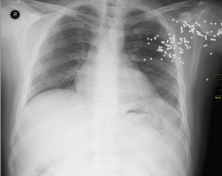 <p>dark = less dense</p><p>bright = more dense</p>