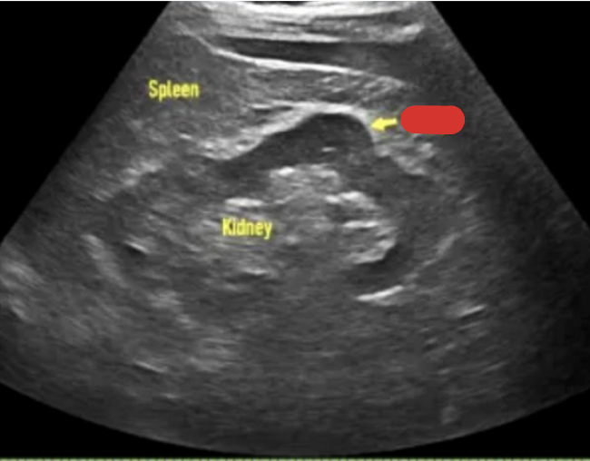<p>What is the arrow pointing at?</p>