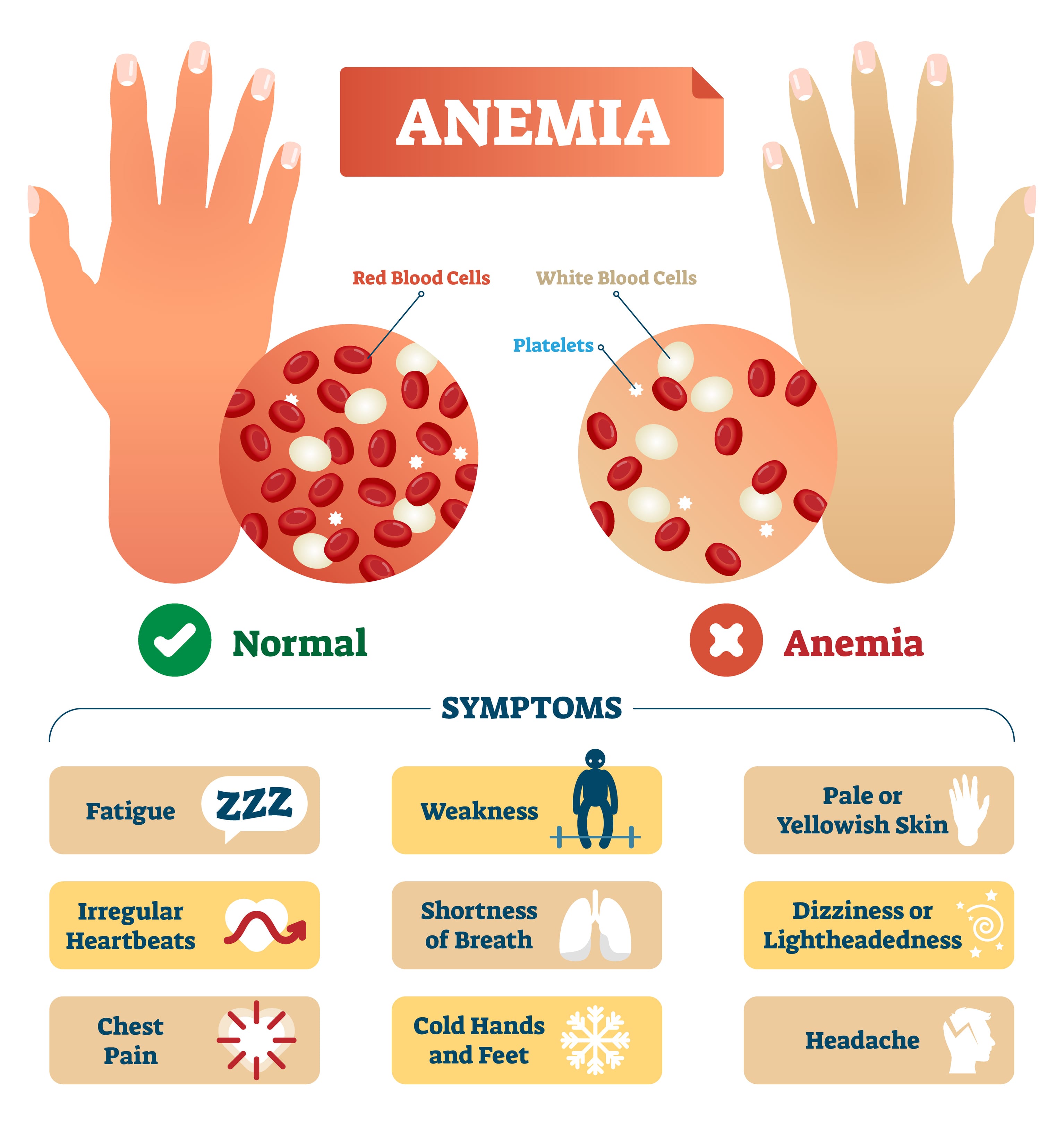 <p>Explain why iron deficiency can lead to anemia?</p>