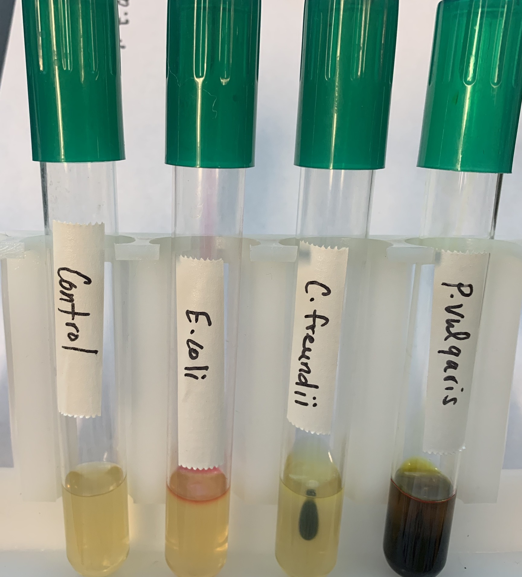 <p>#19 SIMS Test </p><ul><li><p>I - production of Indole </p></li></ul><p></p>