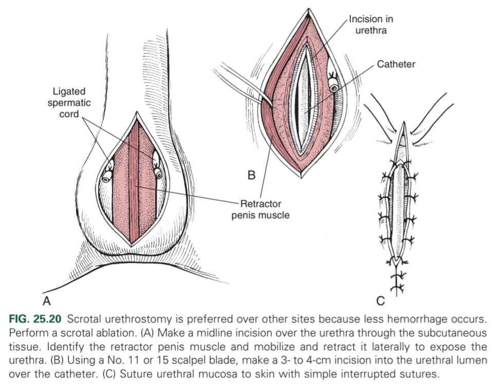 <p>Dorsal recumbency: place urinary catheter, elliptical incision around or near base of scrotum in intact male dogs or remnants of neutered ones.</p><p>Castration performed in routine manner.</p><p>Interrupted sutures placed on tunica albuginea to subcutaneous tissue on either side of urethrostomy site.</p><p>Incision into lumen of urethra on ventral midline.</p><p>Closed by suture to skin on each side in a single layer simple interrupted or continuous pattern, monofilament, absorbable or nonabsorbable.</p>