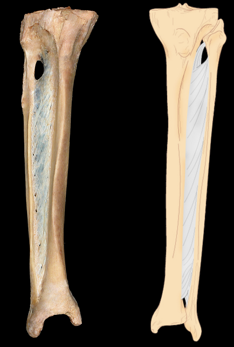 <p>What type of fibrous joint and subtype</p>