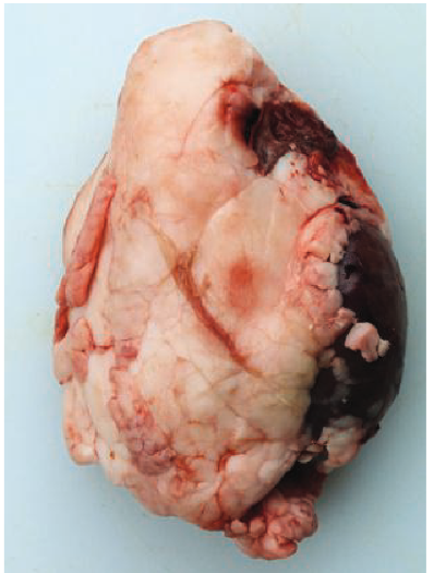 <p>External structure of kidney</p>
