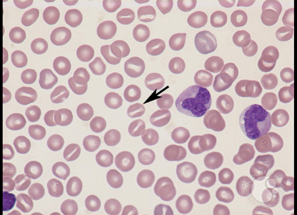 <p>What RBC is this? </p>