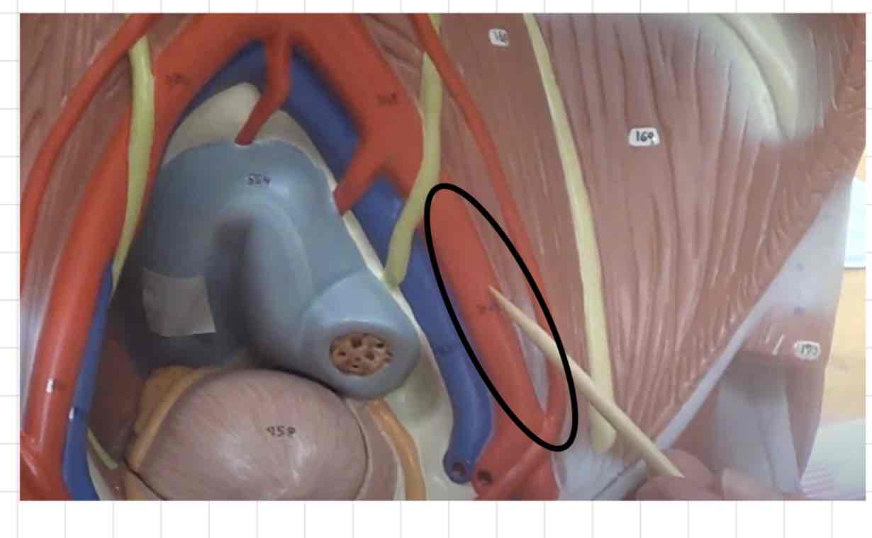 <p>what is this? (torso model)</p>