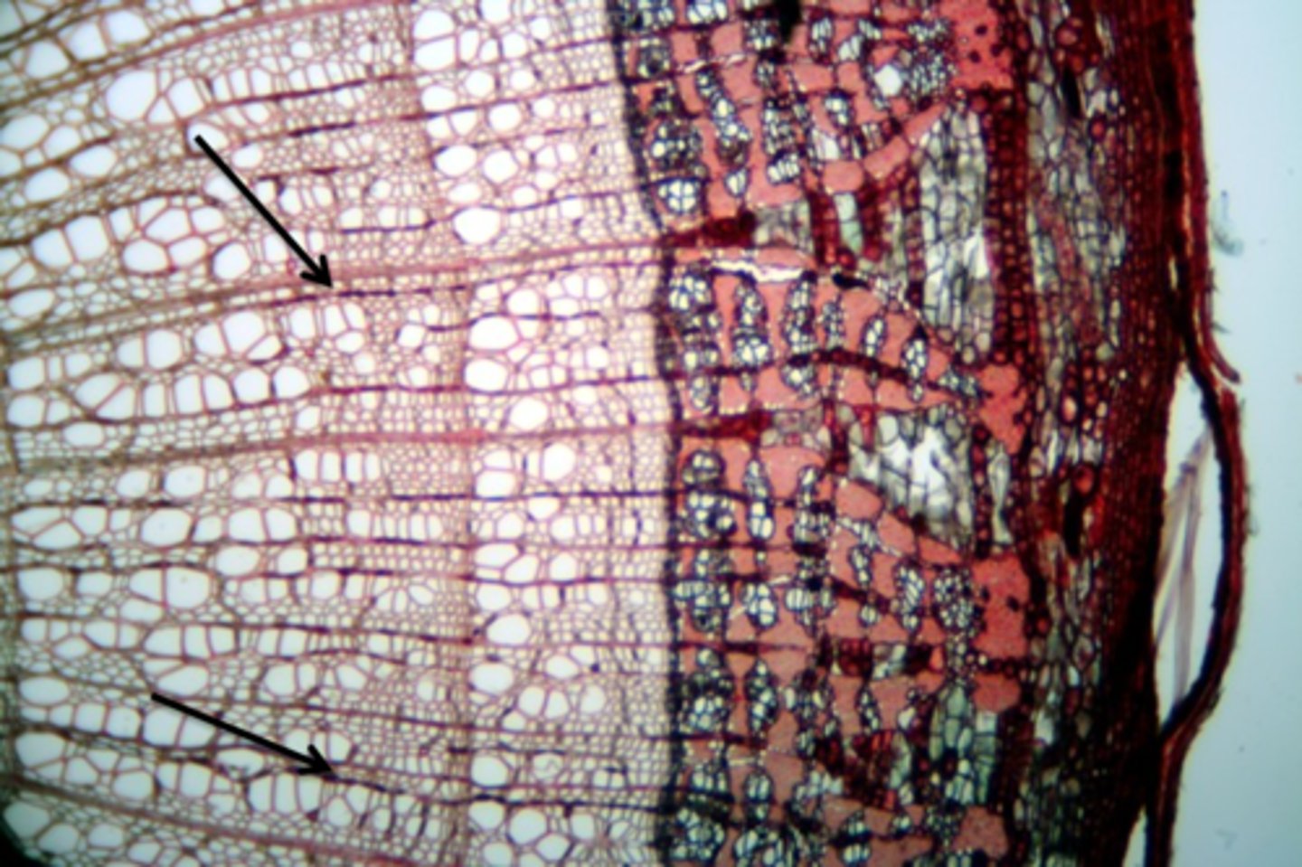 <p>a vascular ray located in the xylem</p><p>- Provides lateral movement of water and minerals in woody stems</p>