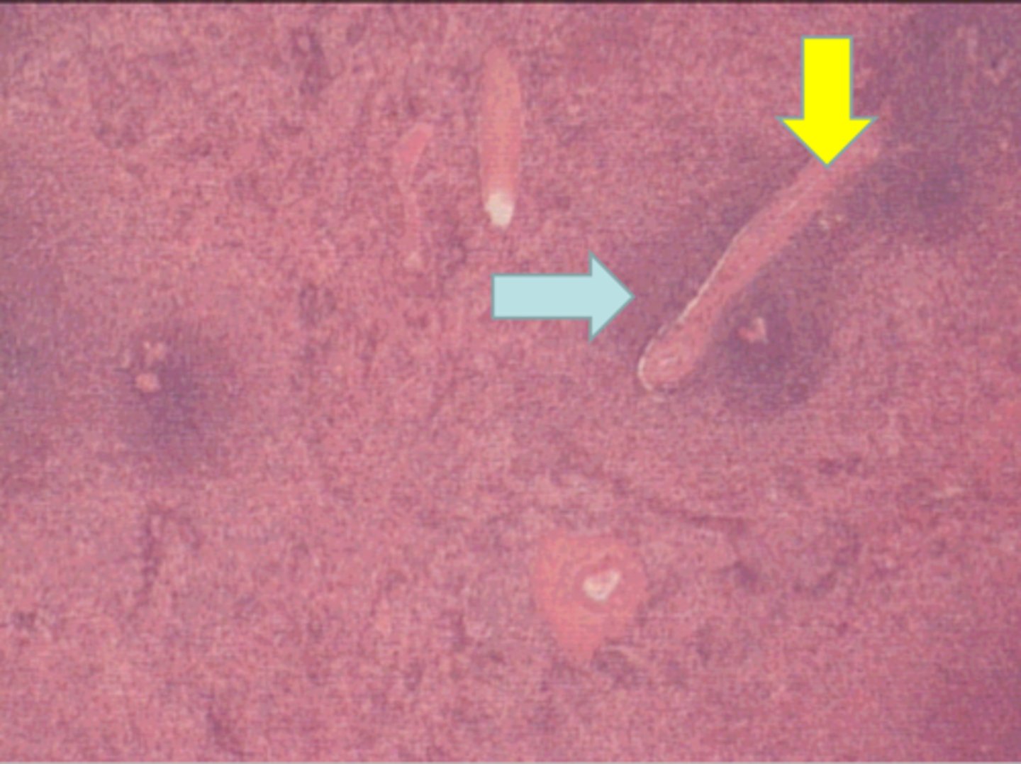 <p>Where is this tissue?</p><p>spleen</p>