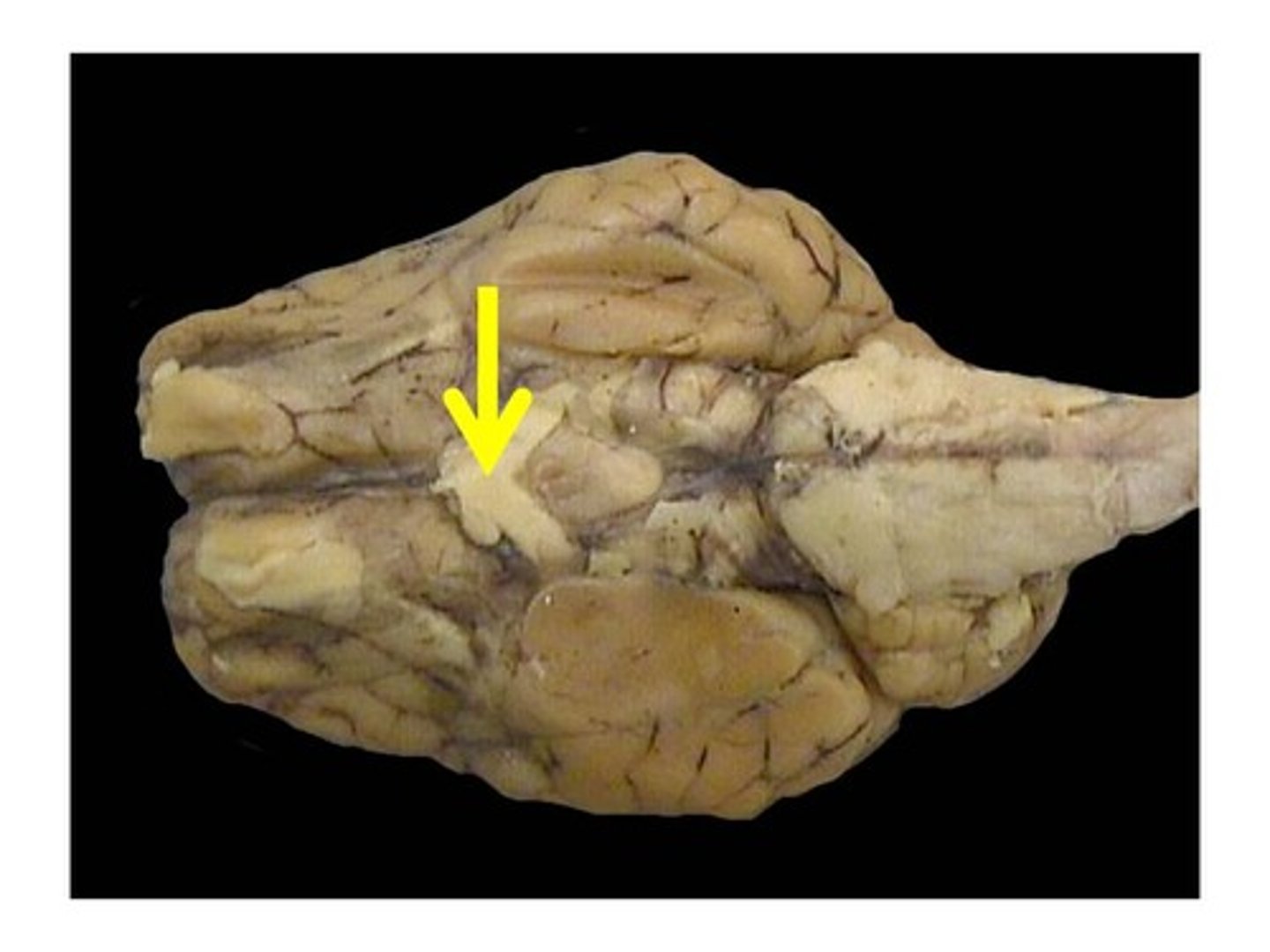 <p>Point where optic nerves partially cross over</p>