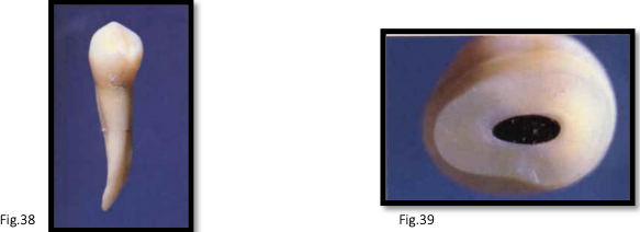 <p>canal anatomy of <strong>mn 1st premolar</strong></p>