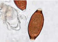 <ul><li><p><span>54 x 22 um</span></p></li><li><p><span>Distinct barrel shape</span></p></li><li><p><span>Refractile, convex, hyaline polar plugs at both ends</span></p></li><li><p><span>Unembryonated internal mass</span></p></li></ul><p></p>