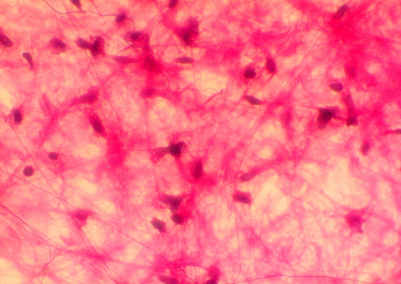 <p>Loose fibrous connective tissue</p>