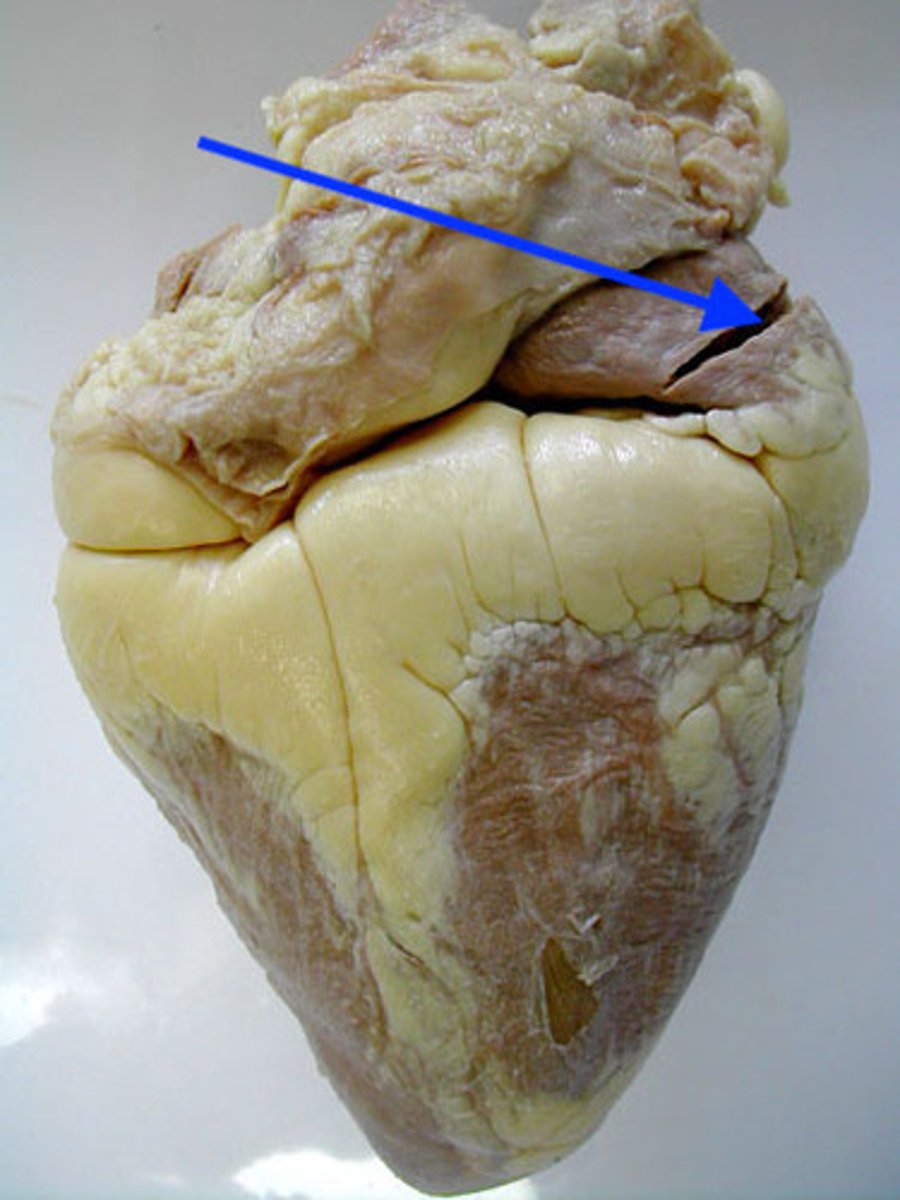 <p>Identify the blood vessel</p>