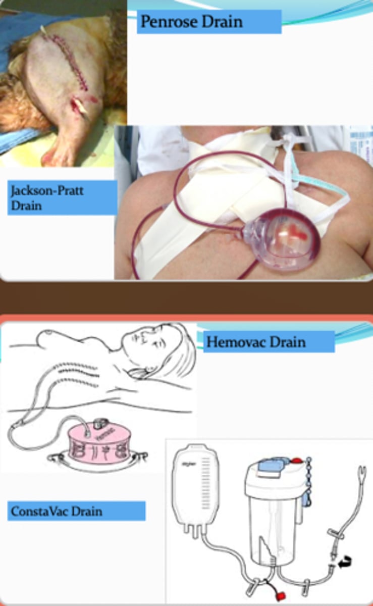 <p>- Use following abdominal and thoracic surgery to collect fluid and blood.</p><p>o Jackson Pratt (bulb) or hemovac</p>