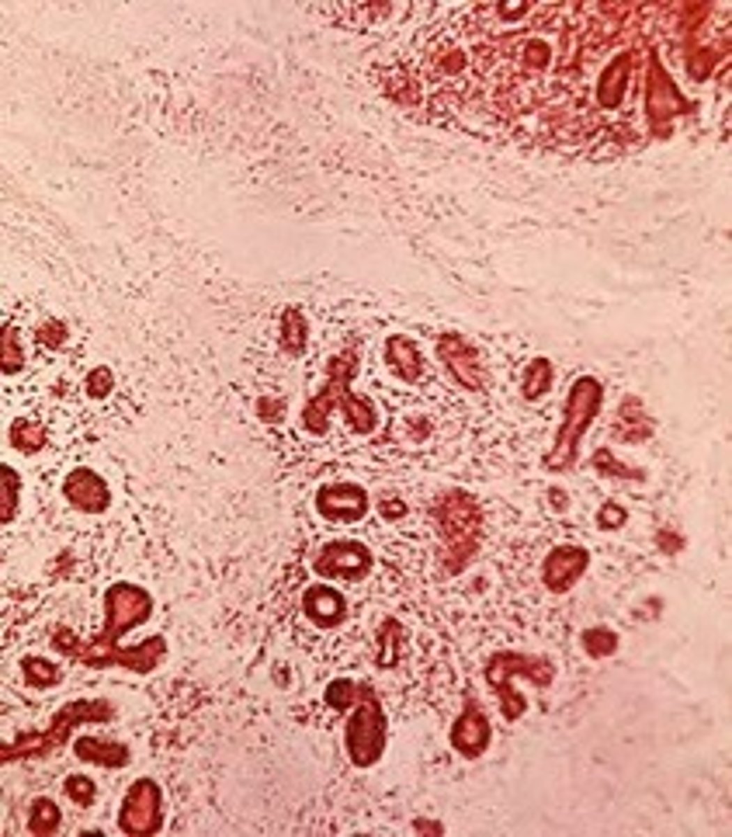 <p>Describe the difference between the glands seen above and active glands</p>