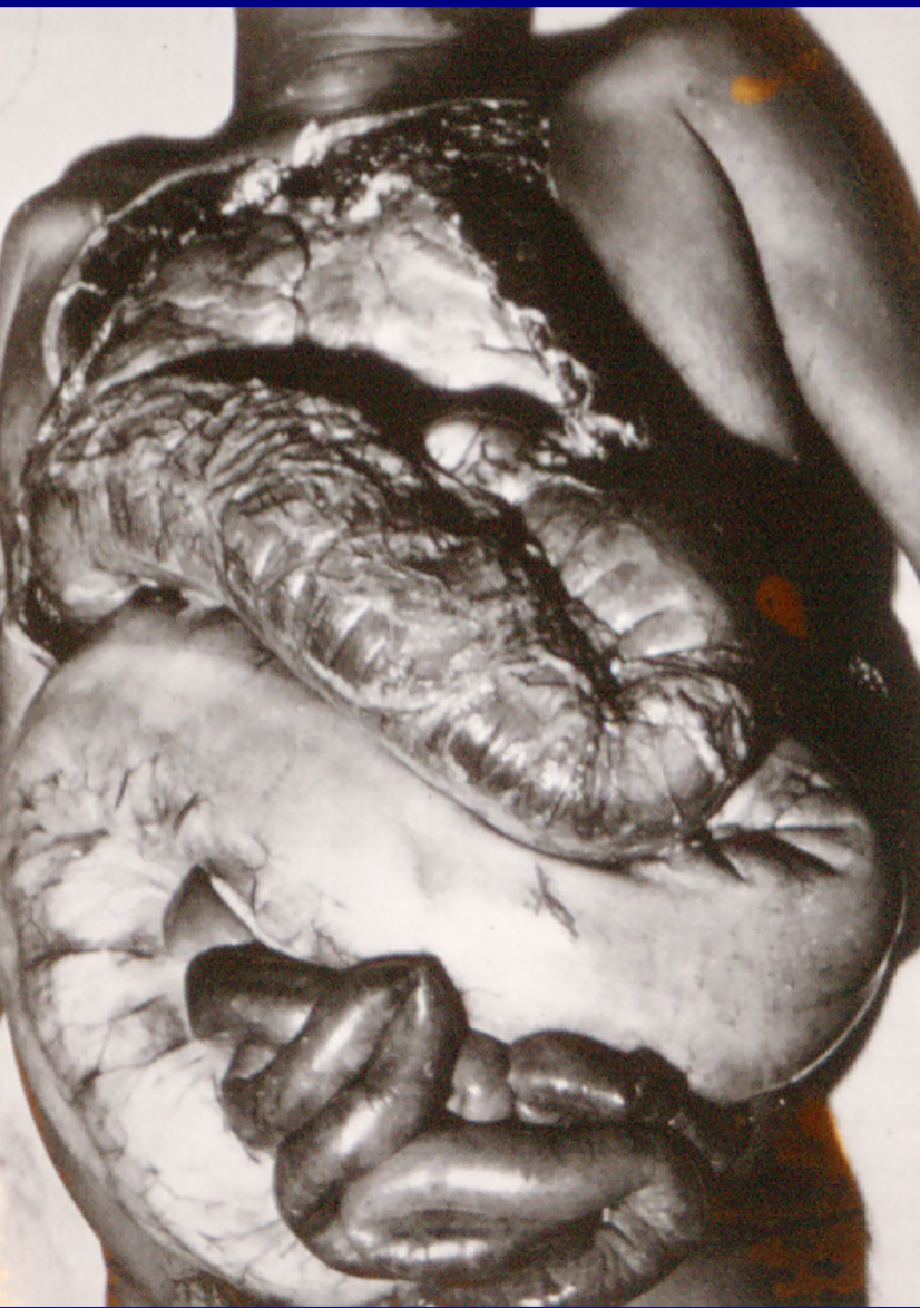 <p>what parasite is <span>Megaesophagus and Megacolon associated with</span></p>
