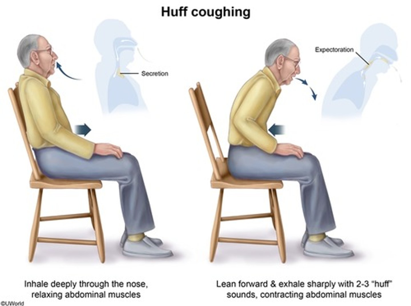 <p>- less painful</p><p>- less fatiguing</p><p>- helps stabilize collapsible bronchiole walls</p><p>- air gets behind mucus</p>