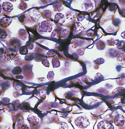 <p>What tissue type does this image depict?</p>