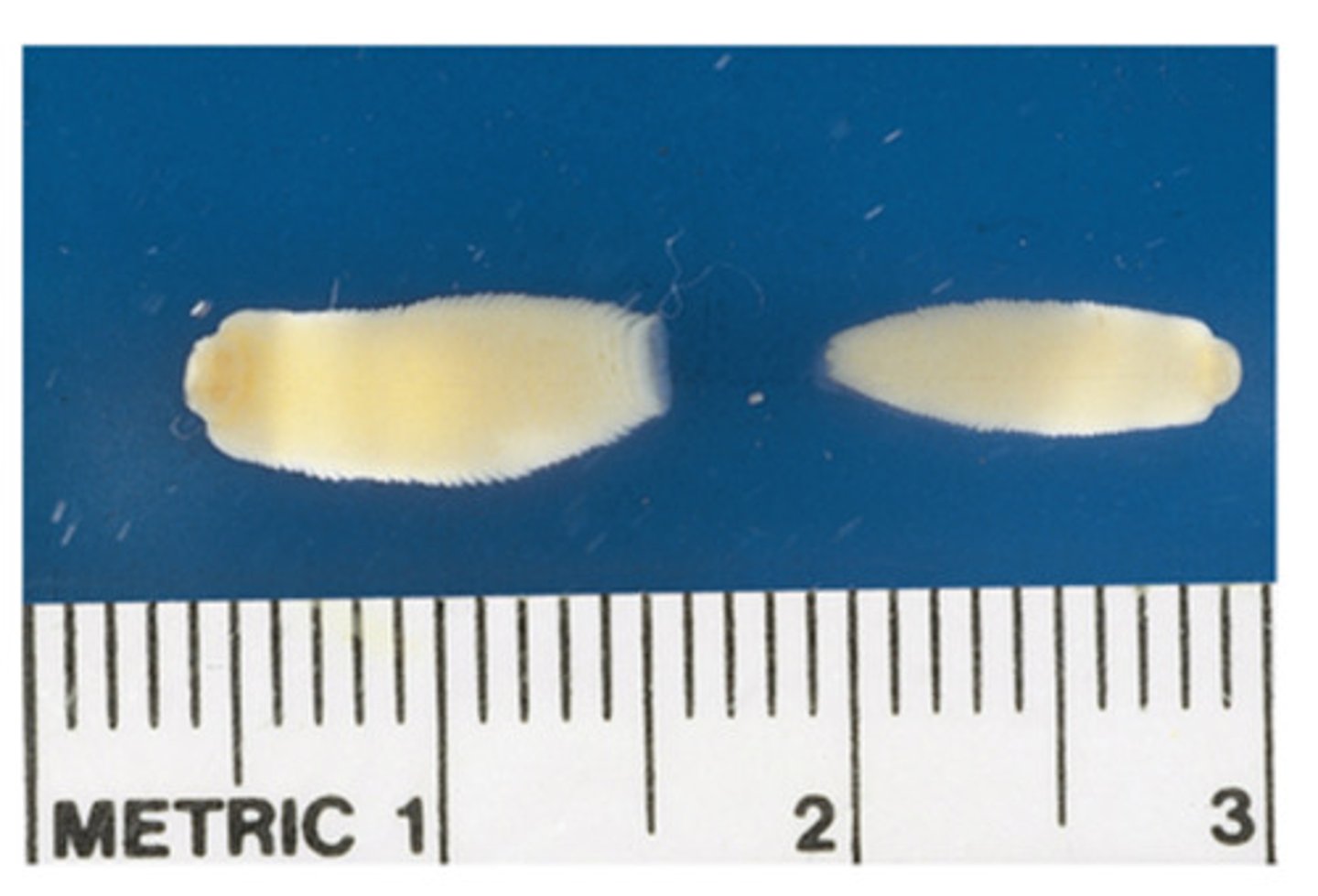 <p>The dwarf tapeworm of horse bears the name (genus and species)</p>
