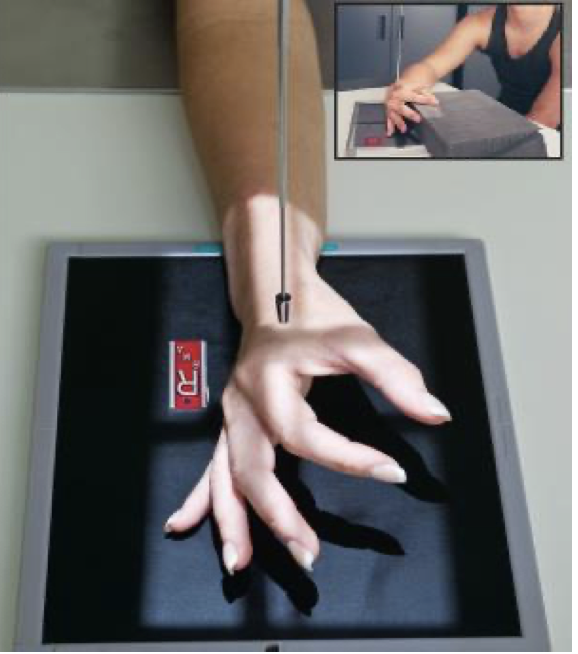 <p>Patient Position</p><ul><li><p><span style="line-height: normal;">&nbsp;</span>Sitting at side or end of table</p></li><li><p class="p1"><span style="line-height: normal;">&nbsp;</span>Arm (humerus) is abducted</p></li><li><p class="p1"><span style="line-height: normal;">&nbsp;</span>Elbow is flexed 90<span style="line-height: normal;">&nbsp;degrees</span></p></li><li><p class="p1"><span style="line-height: normal;">&nbsp;</span>Forearm is resting on table</p></li></ul><p class="p1">Part Position</p><ul><li><p class="p1"><span style="line-height: normal;">&nbsp;</span>Hand is placed in a lateral position with the medial aspect ( pinky side) of&nbsp;<span style="font-size: 1.6rem;">hand on the IR</span></p></li><li><p class="p1"><span style="line-height: normal;">&nbsp;</span>Fingers &amp; thumb are spread out like a “fan”</p></li><li><p class="p1"><span style="line-height: normal;">&nbsp;</span>Phalanges are kept parallel to IR</p></li><li><p class="p1"><span style="line-height: normal;">&nbsp;</span>Metacarpals are superimposed</p></li><li><p class="p1"><span style="line-height: normal;">&nbsp;</span>** Use metacarpals to judge accuracy of positioning not the radius and ulna</p></li></ul><p class="p1">CR</p><ul><li><p class="p1">CR centered to 2<span style="line-height: normal;">nd</span> MCP</p></li></ul><p class="p1">Collimation</p><ul><li><p class="p1">Include all carpals, metacarpals, phalanges and distal portion of radius and ulna</p></li></ul><p></p>