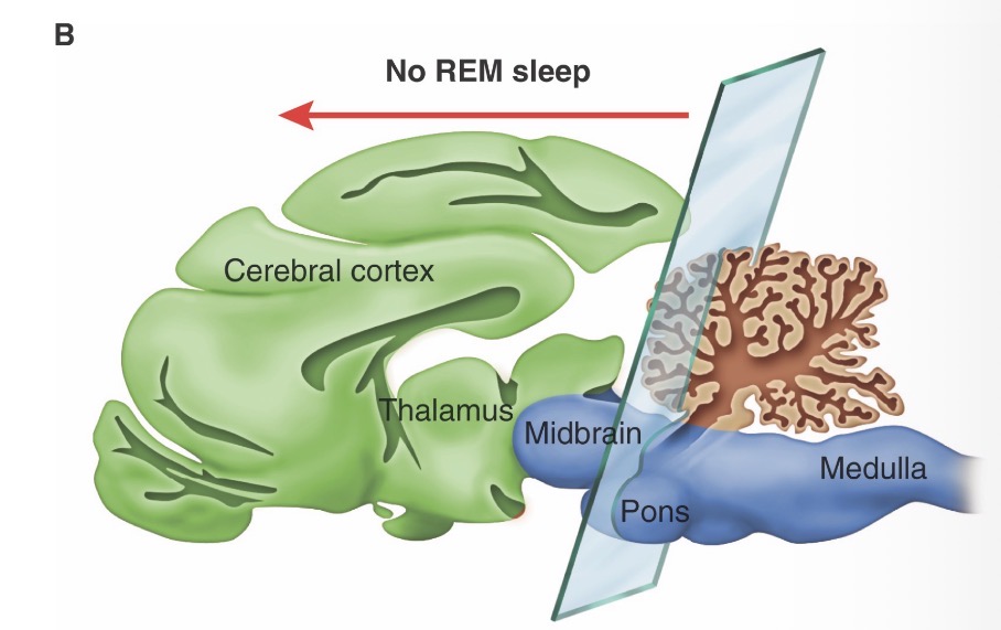 <p>no REM sleep</p>