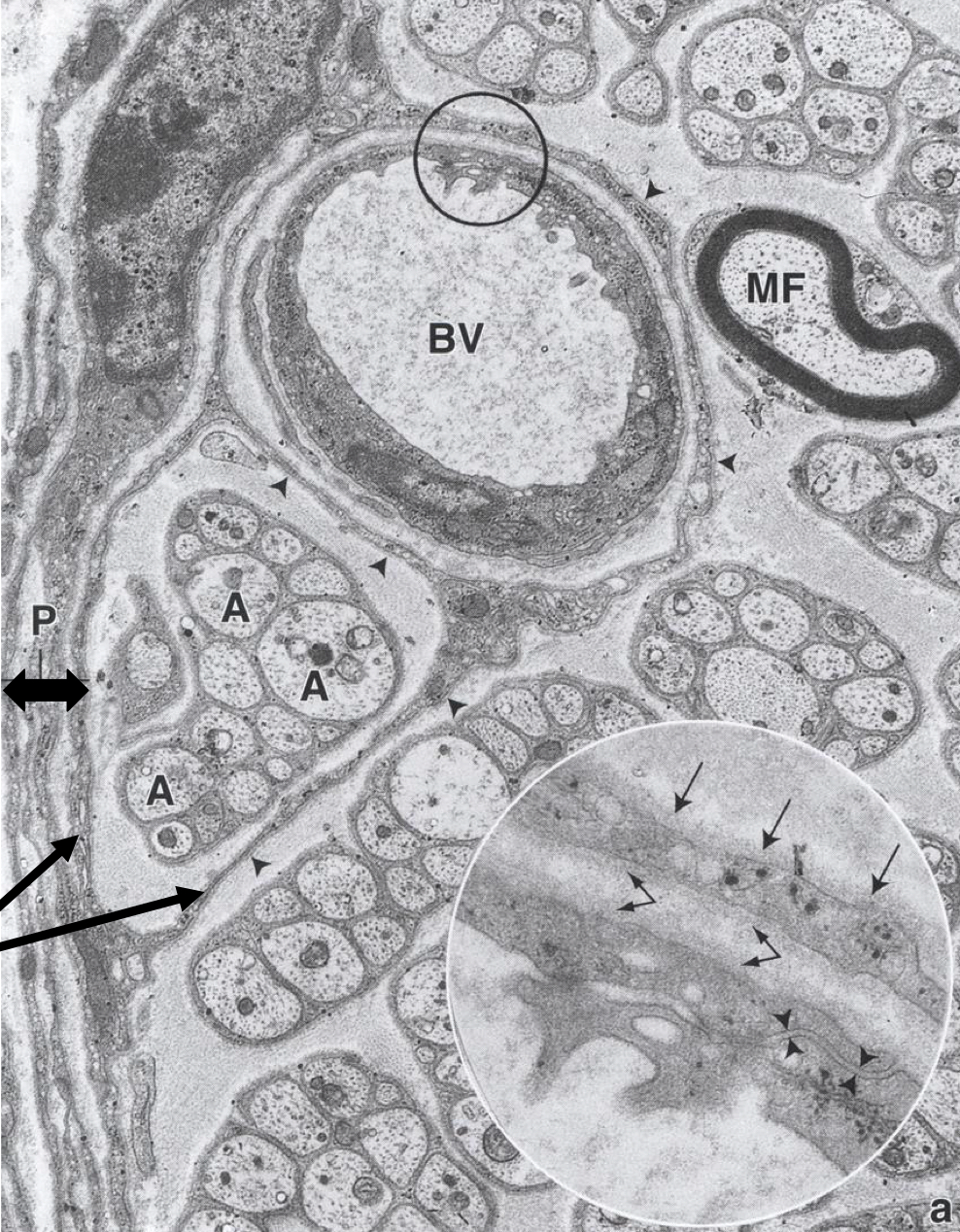 <p>perineurium </p>