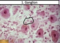 What type of glial cells?